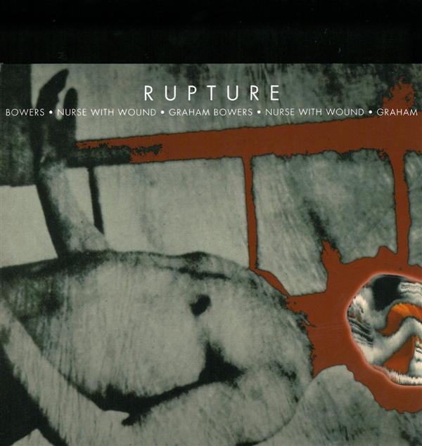 RUPTURE